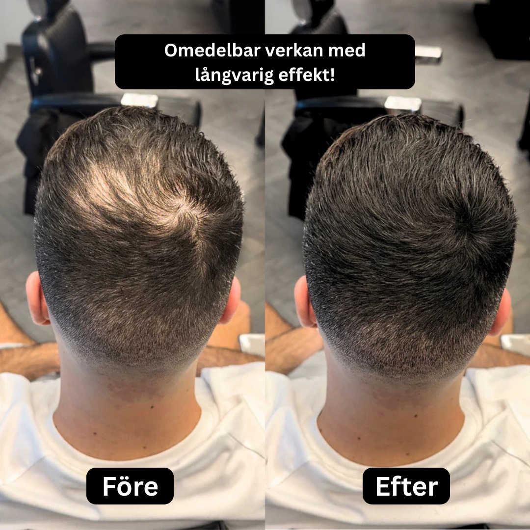 Thicker™ – Från tunt till fylligt hår utan kirurgi eller dyra behandlingar!